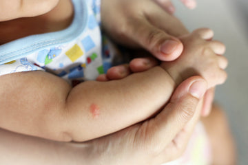Expert Advice: How to Stay Protected from Mosquitoes and Prevent Disease